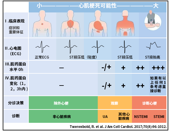 心肌梗死早期診斷圖