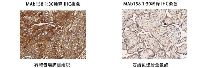 鼠抗人PD-L1抗體案例