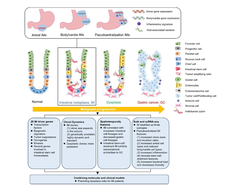 腸化生癌前病變圖