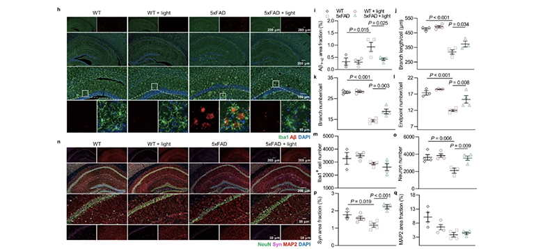 光療對(duì)基因表達(dá)的影響