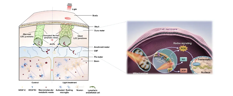mLVs靶向光療改善AD病理的機(jī)制示意圖